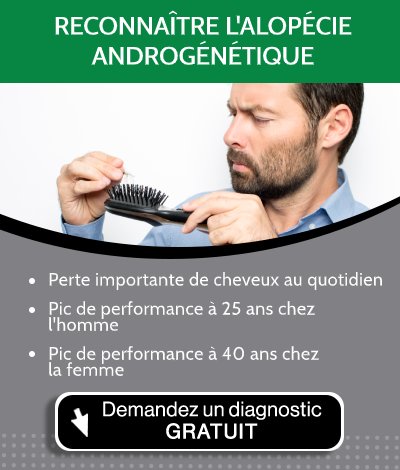 Homme qui perd des cheveux sans savoir si c'est naturel ou une alopécie androgénétique